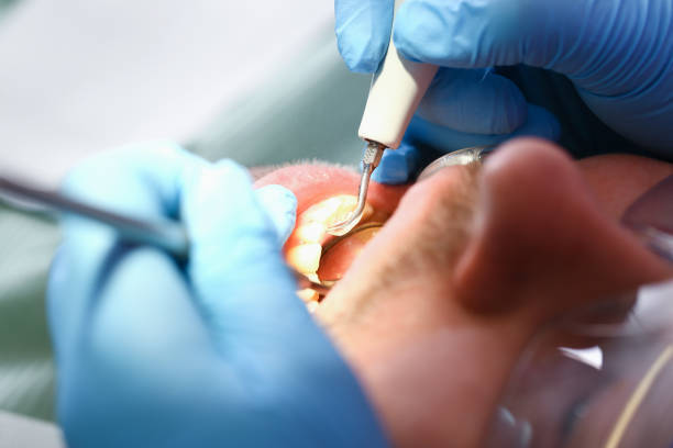 Best Cracked Tooth Emergency Dentist  in Cloverly, MD
