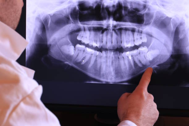 Best Broken Tooth Emergency  in Cloverly, MD